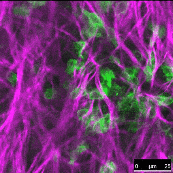 A Flash on Jupiter, the Death of Mitochondria